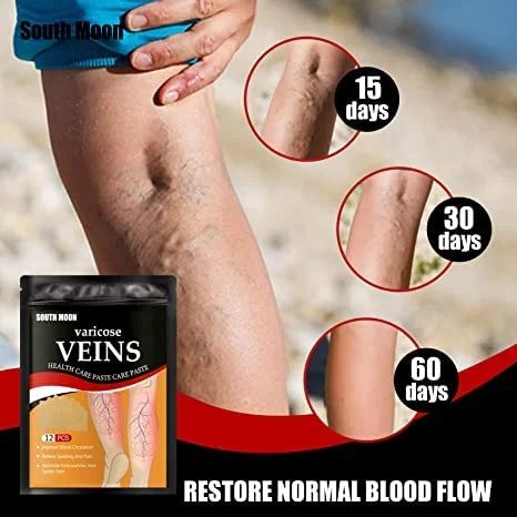Varicose Vein Patch Set Of 12 Patch In One Pack