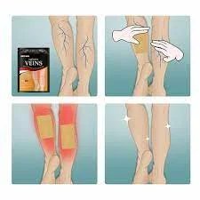 Varicose Vein Patch Set Of 12 Patch In One Pack